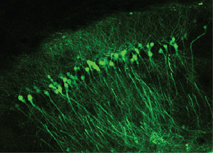 A group of neurons forming a brain circuit