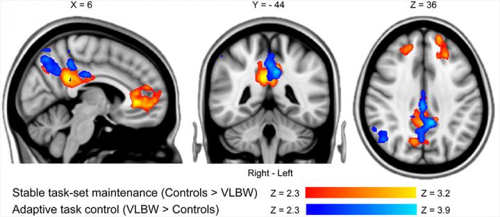 Reactive Versus Proactive Cognitive Control