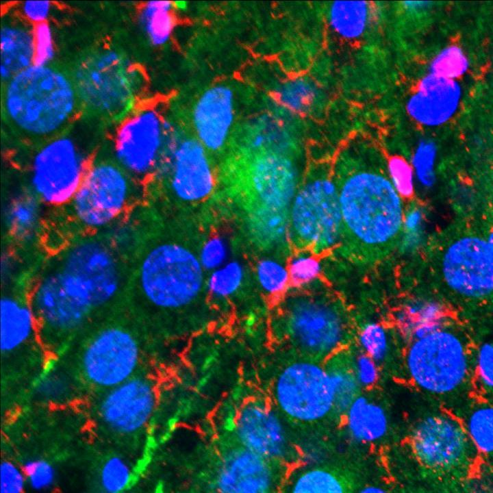 TIA1 in the Ventral Hippocampus
