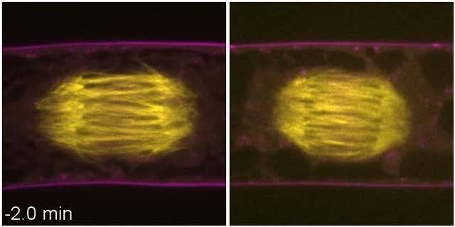 Cell Plate Formation