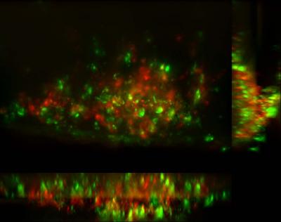TB Bacteria Prod Epithelial Cells to Produce MMP9