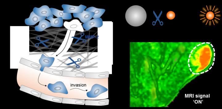 Detection of Cancer Metastasis using Nano MRI Lamp