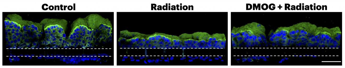 Radiation Injury in a Gut-on-a-Chip