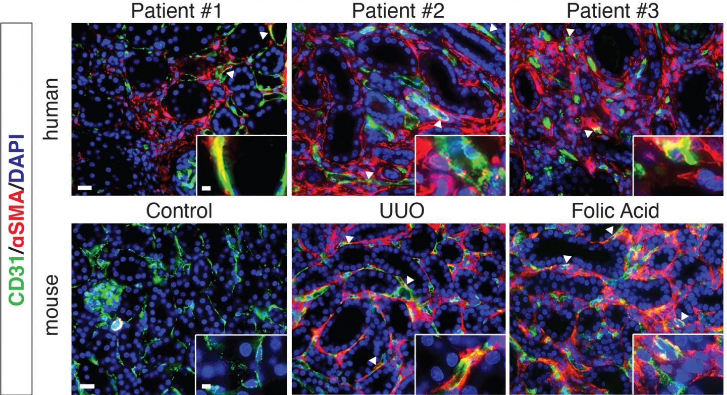 Molecular Cascades from a Cell Transition Disrupt Blood Vessels and Drive Kidney Fibrosis (1 of 1)