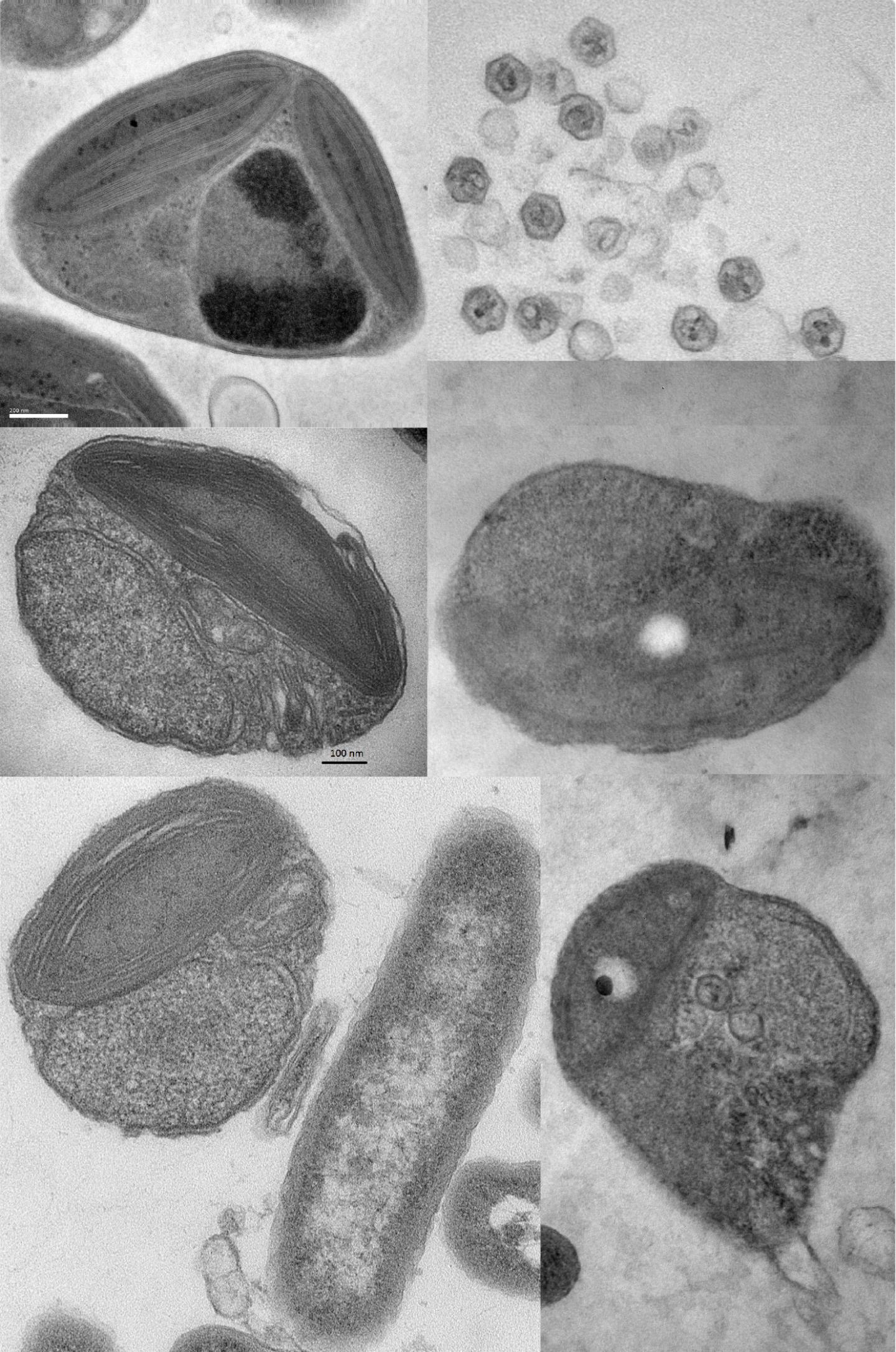 Tiny but Mighty: Genetically Diverse Picophytoplankton Resist Viral Attacks (2 of 2)