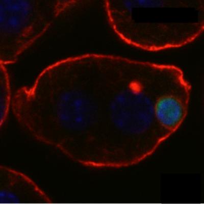 Liver Cell Engulfs T-cell