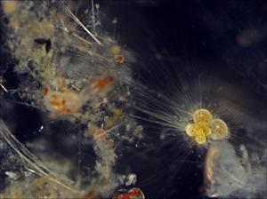 Light microscope image of a planktonic foraminifera