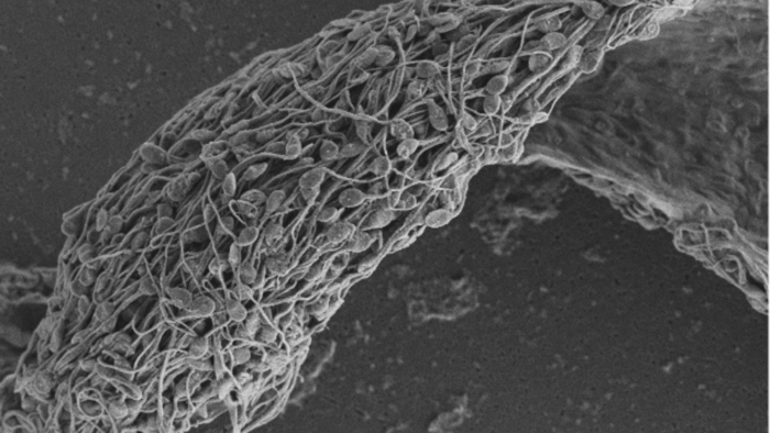 Antibodies stop sperm in their tracks