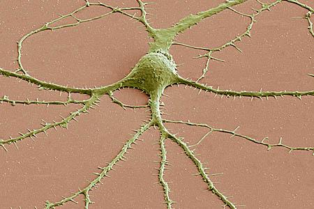 Neuron