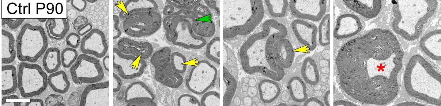 Sciatic Nerves from 3-Month-Old Mice in Cross Section