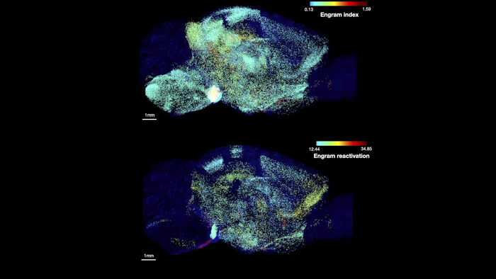 Régions cérébrales impliquées dans la mémoire