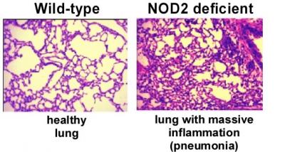 Mouse Lung Cross-sections