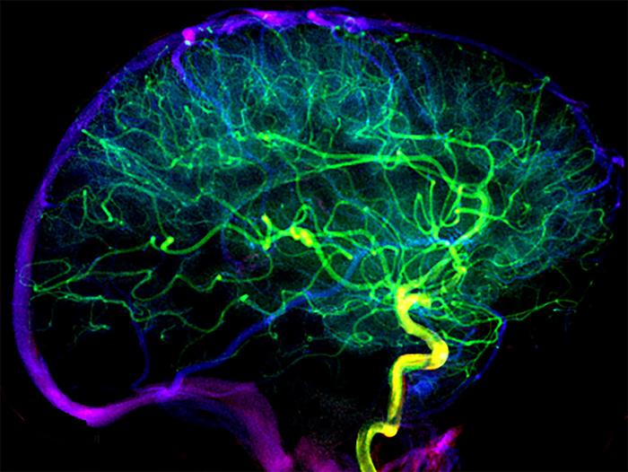 Blood vessels in the brain