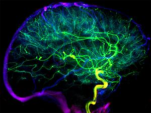 Blood vessels in the brain