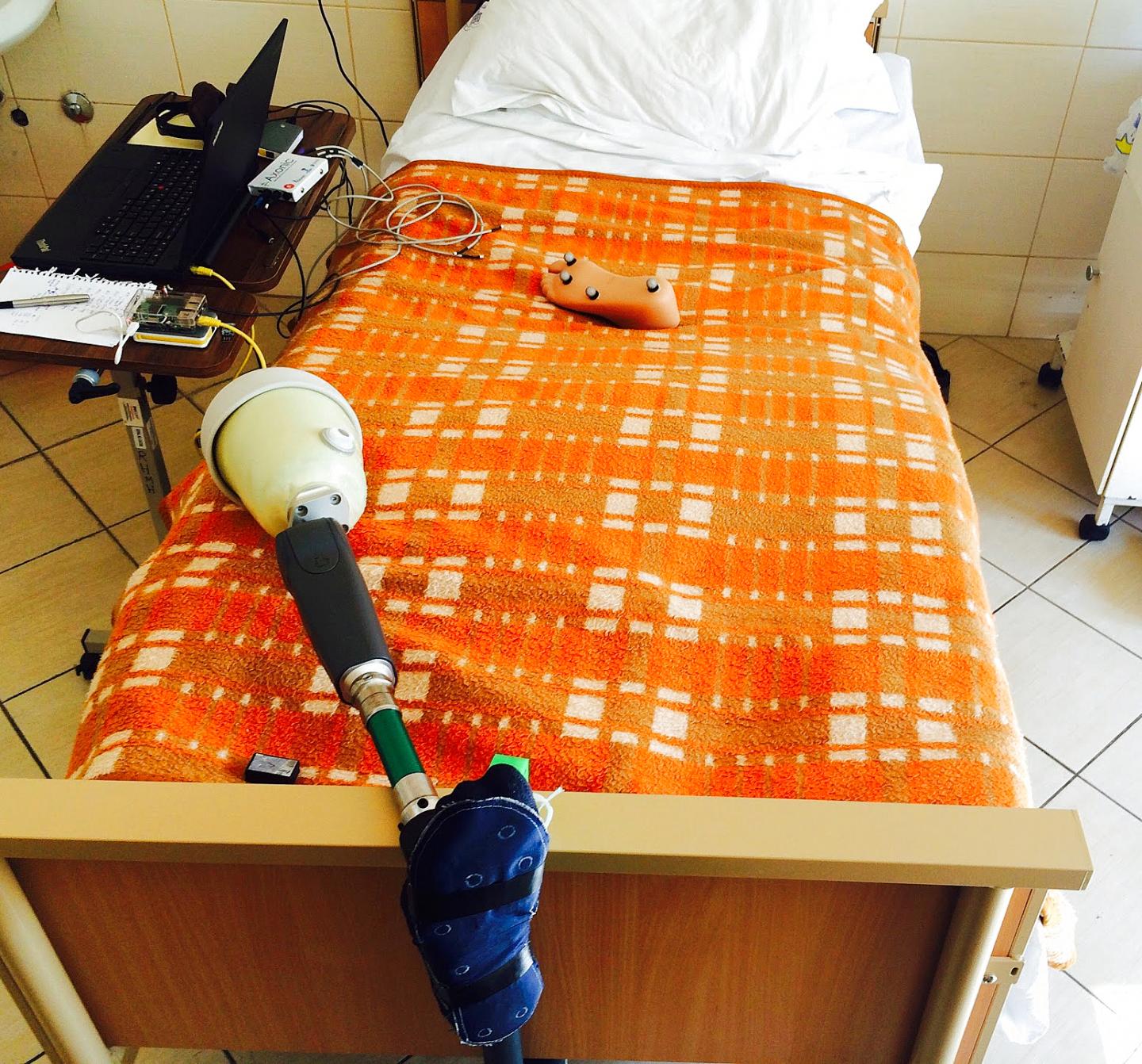 Nerve-Stimulating Leg Prosthesis Improves Movement and Functionality in Amputees (1 of 10)