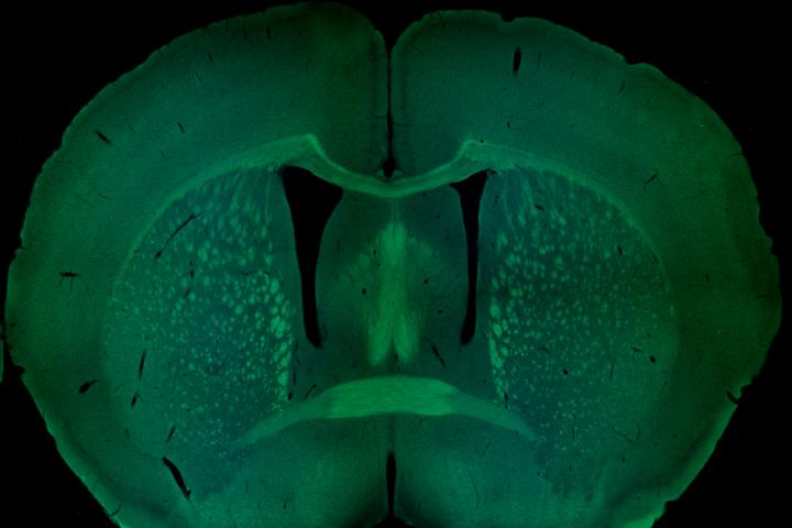Coronal section of mouse brain