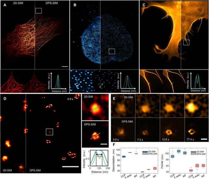 Deep-physics-informed sparsity framework universally extends the spatial resolution of structured illumination microscopy for different biological samples