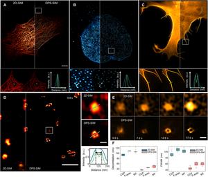 Deep-physics-informed sparsity framework universally extends the spatial resolution of structured illumination microscopy for different biological samples