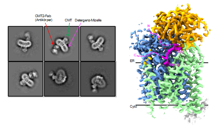Cryo-EM reconstruction of the structure of the CMT