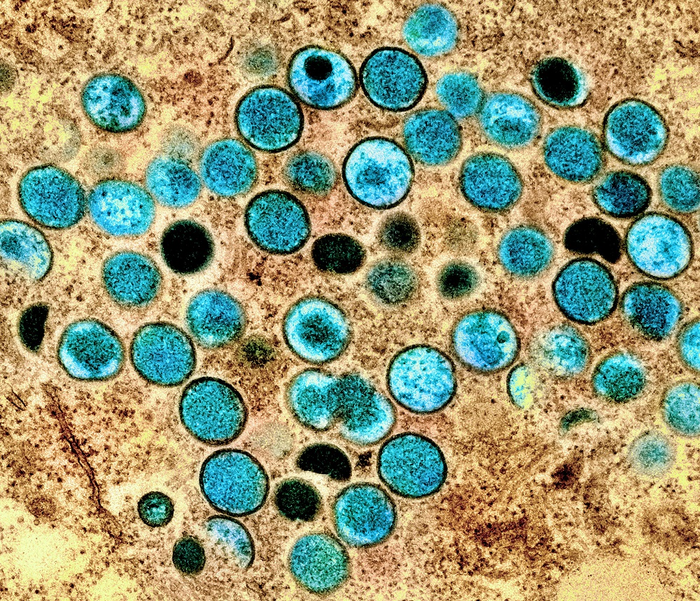 Colorized transmission electron micrograph of monkeypox particles (teal) found within an infected cell (brown), cultured in the laboratory. Image captured and colour-enhanced at the NIAID Integrated Research Facility (IRF) in Fort Detrick, Maryland
