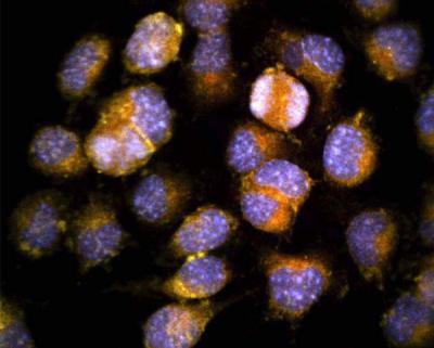Co-Localization of sAPP-α and BACE1 in Neuronal Cells