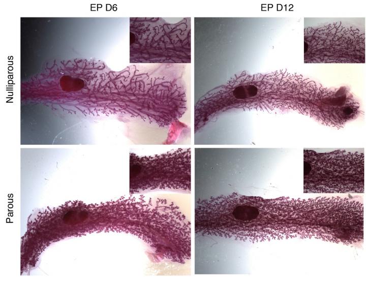 Mammary Cells 'remember' Earlier Pregnancy
