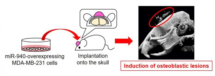 Fig.2  Cancer-secreted hsa-miR-940 Induces Osteoblastic Lesions in the Bone Microenvironment