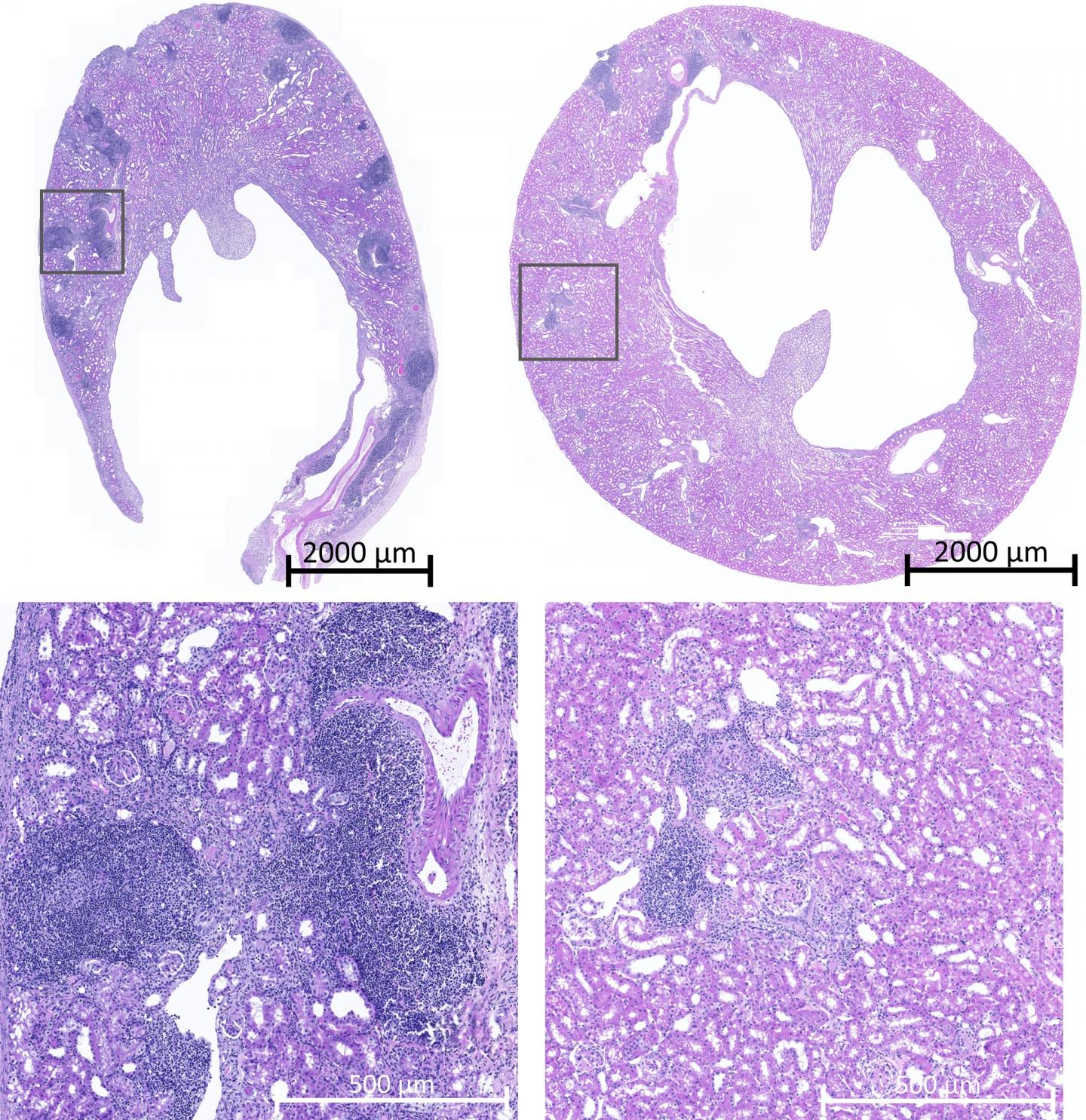 Image of transplanted mouse kidney tissues.