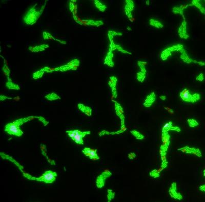 Living <i>Listeria</i>