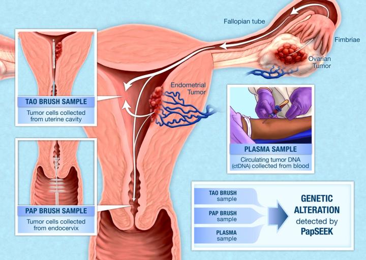 中文 pap smear Cervical cancer