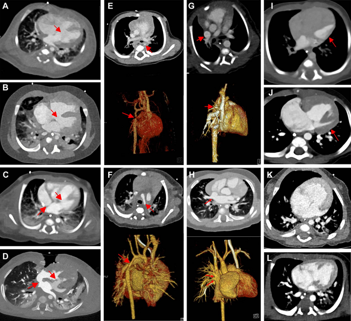 Imaging in Babies with Heart Defects