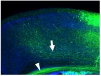 Figure 2. Trace of Axonal Fiber Bundles in the Mouse Brain