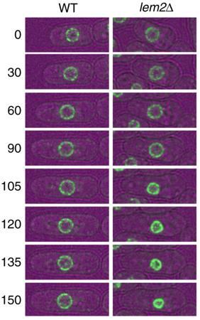 Difference In Nuclear Size Of Normal And Mutant LEM2-Deficient Cells When Treated With Cerulenin