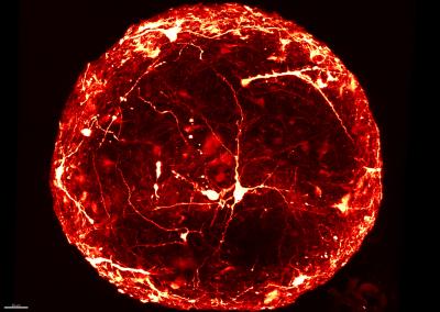 A seven month old 3D 'mini-brain'