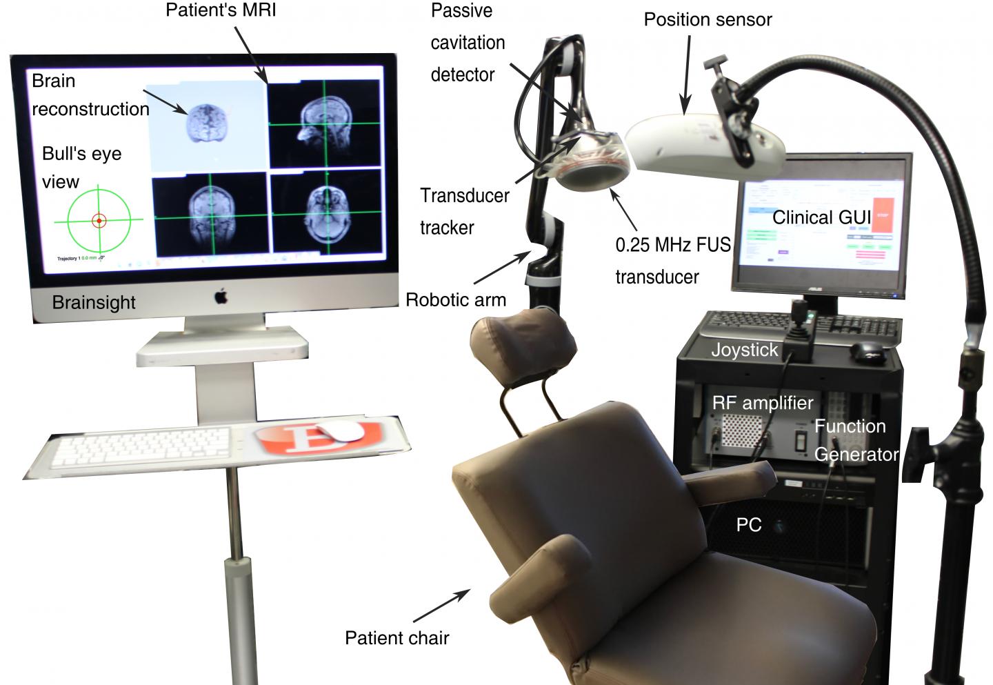 Portable Ultrasound System for Targeted and Non-Invasive Blood-Brain Barrier Opening in Humans