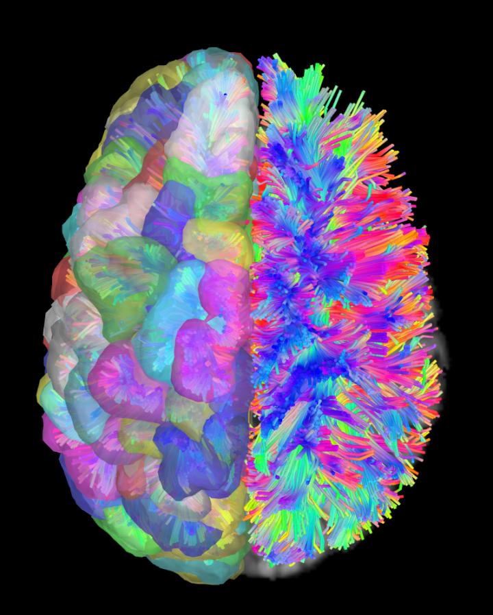 Brain Wiring Diagrams