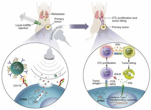 UTSW researchers develop microbubble technology to enhance cancer immunotherapy