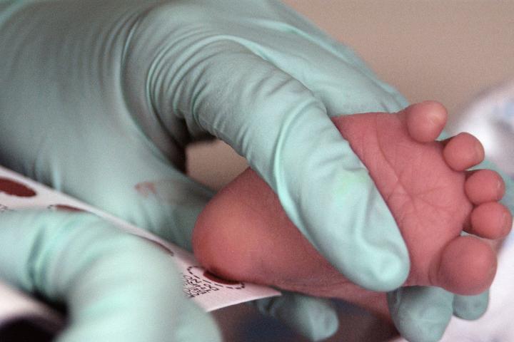 Newborn Screening Test developed for Rare, Deadly Neurological Disorder
