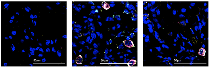 Macrophages in lungs