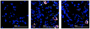 Macrophages in lungs