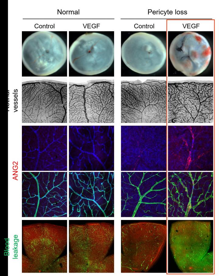 Accelerated Blood-Retinal Barrier Destruction
