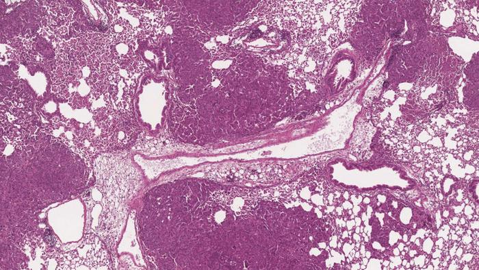 MMRd tumors in mouse lungs