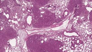 MMRd tumors in mouse lungs