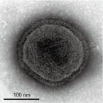 Electron Micrograph of Sendai Virus