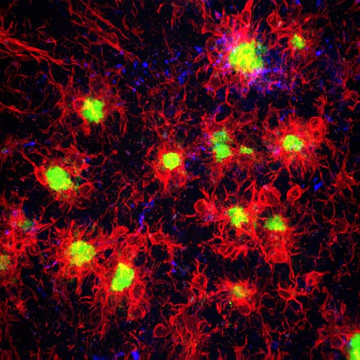 Microglia in the Alzheimer's Brain