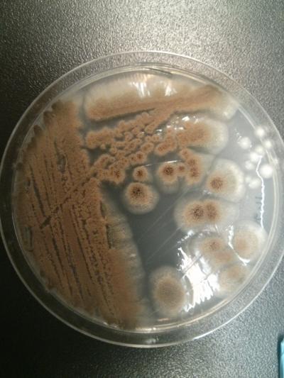 Aspergillus Versicolor