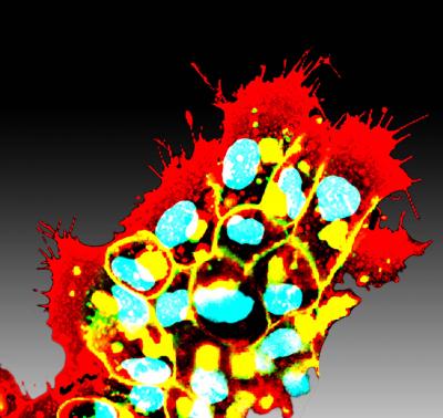 Clusters of Neural Crest Cells