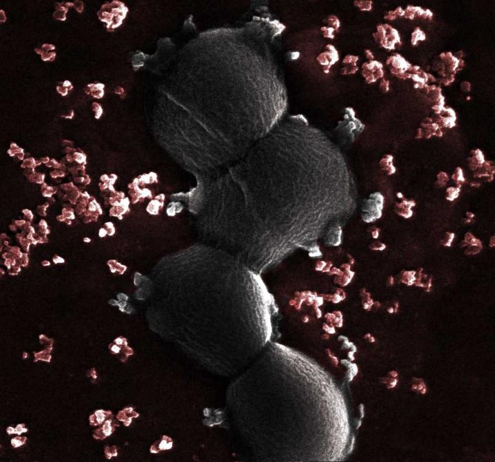 Group B <em>Streptococcus</em> and Pregnancy Complications