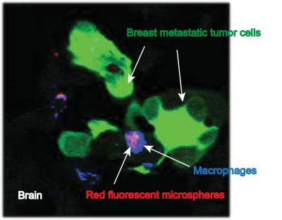 Attacking Metastatic Cancer Cells with Nanoparticles