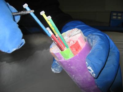 14 New Biomarkers Identified for Type 2 Diabetes